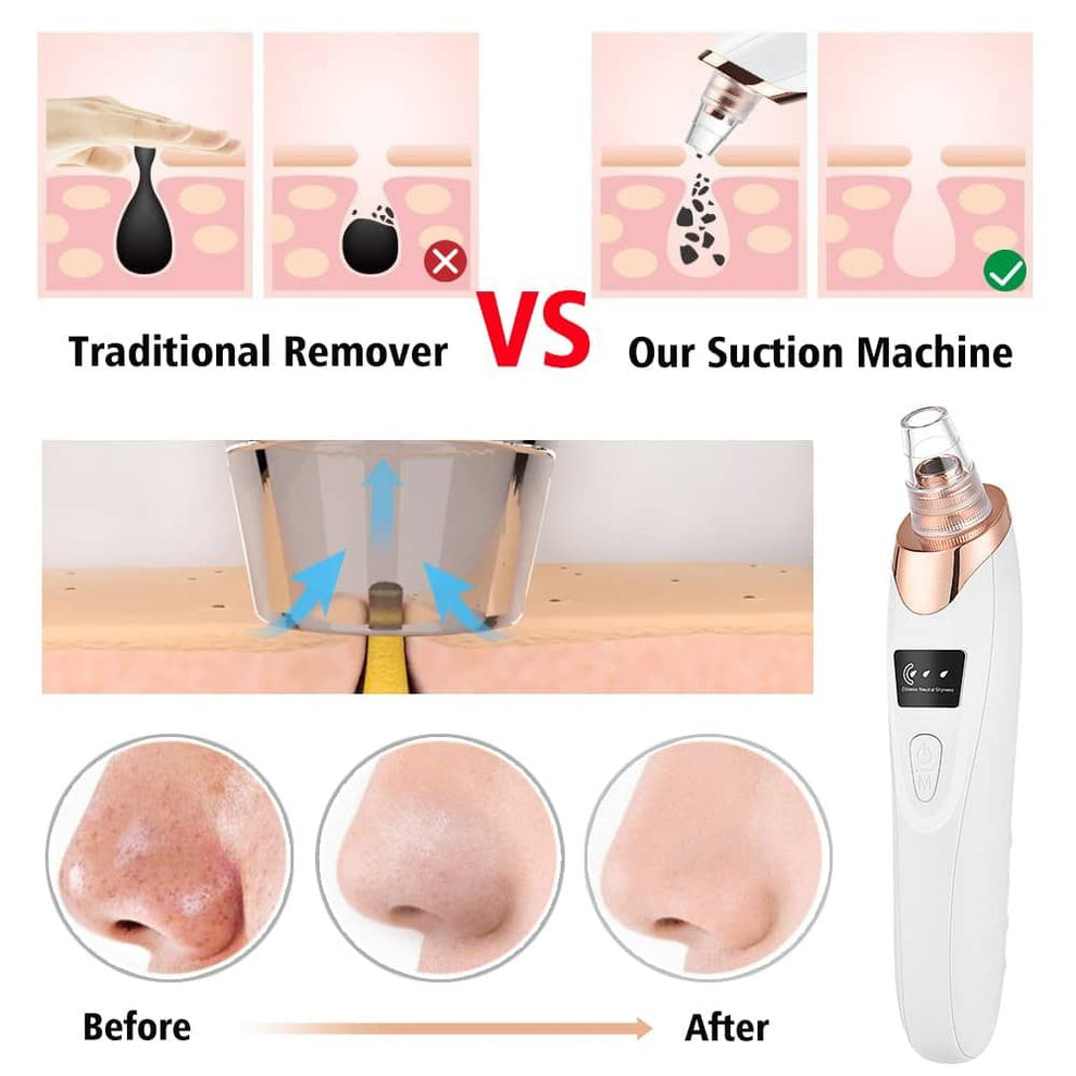 5 in 1 Electric Blackhead Acne Removal Vacuum Suction
