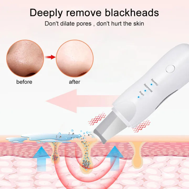 Ultrasonic Skin Scrubber Skin Care Machine Rechargeable  Machine Blackhead Remover