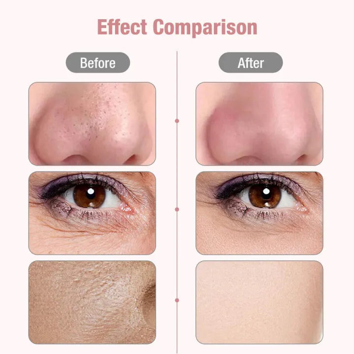Ultrasonic Skin Scrubber Skin Care Machine Rechargeable  Machine Blackhead Remover