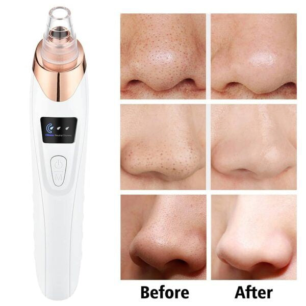 5 in 1 Electric Blackhead Acne Removal Vacuum Suction