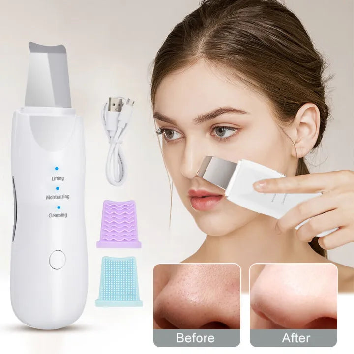 Ultrasonic Skin Scrubber Skin Care Machine Rechargeable  Machine Blackhead Remover